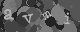 Please type the characters of this captcha image in the input box
